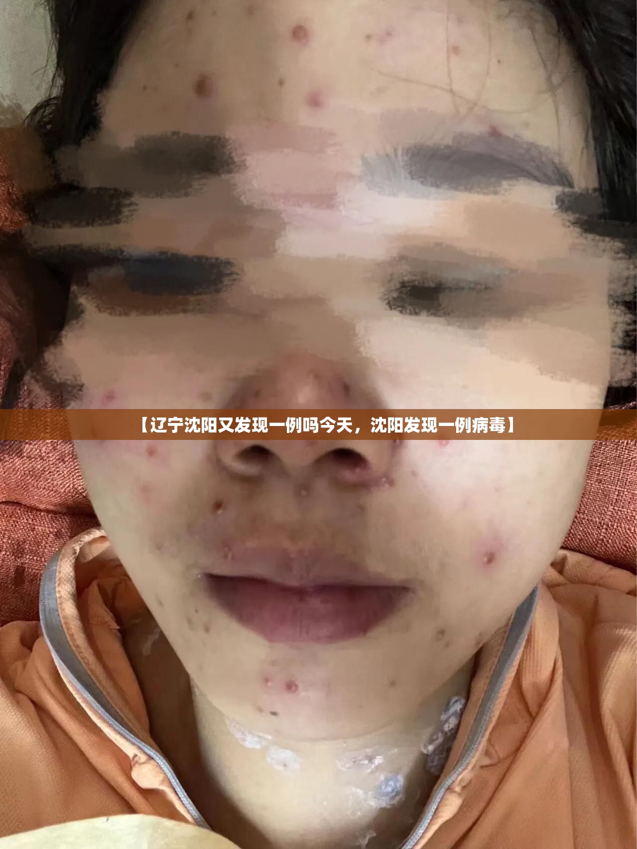 【辽宁沈阳又发现一例吗今天，沈阳发现一例病毒】