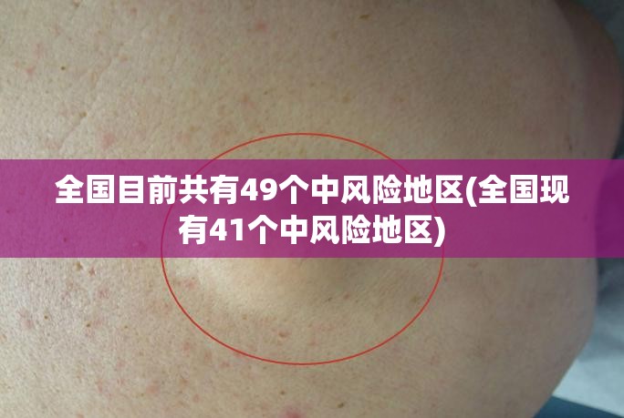 全国目前共有49个中风险地区(全国现有41个中风险地区)