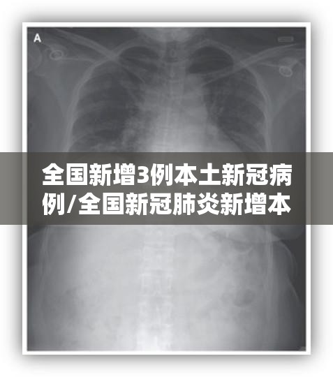 全国新增3例本土新冠病例/全国新冠肺炎新增本土病例 全国新增3例本土新冠病例/全国新冠肺炎新增本土病例