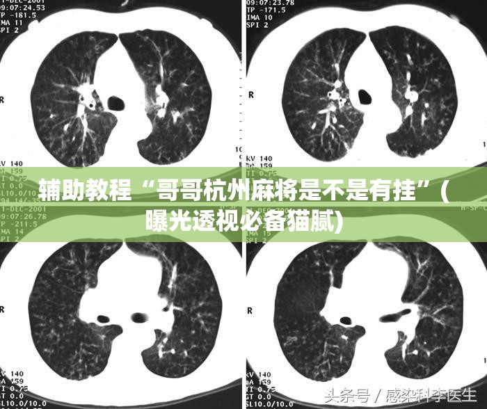 辅助教程“哥哥杭州麻将是不是有挂”(曝光透视必备猫腻) 辅助教程“哥哥杭州麻将是不是有挂”(曝光透视必备猫腻)