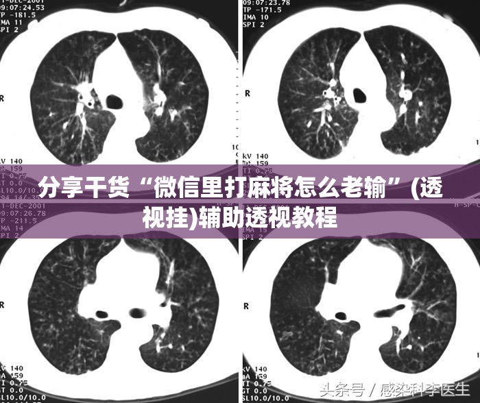 分享干货“微信里打麻将怎么老输”(透视挂)辅助透视教程