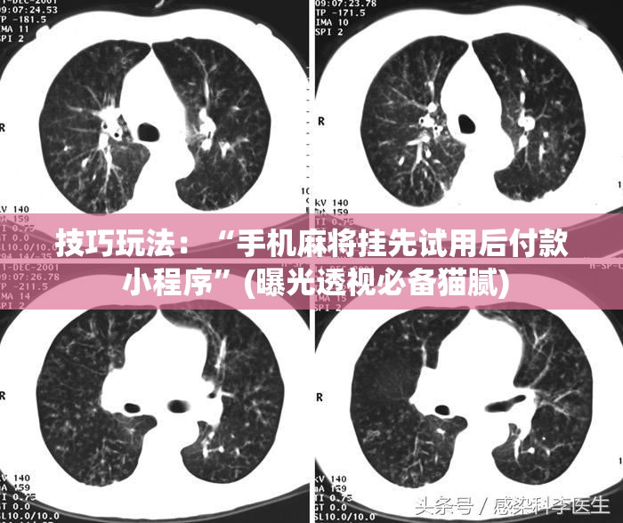 技巧玩法:“手机麻将挂先试用后付款 小程序”(曝光透视必备猫腻) 技巧玩法:“手机麻将挂先试用后付款 小程序”(曝光透视必备猫腻)