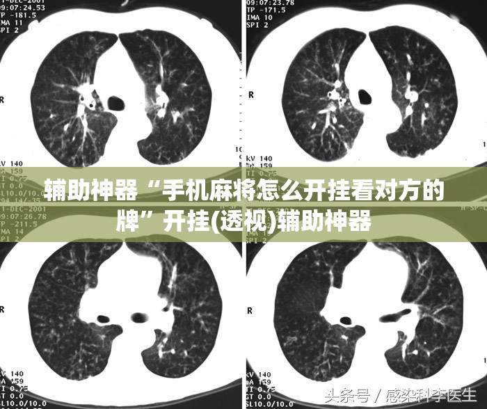 辅助神器“手机麻将怎么开挂看对方的牌”开挂(透视)辅助神器 辅助神器“手机麻将怎么开挂看对方的牌”开挂(透视)辅助神器