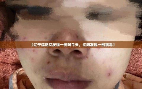 【辽宁沈阳又发现一例吗今天，沈阳发现一例病毒】